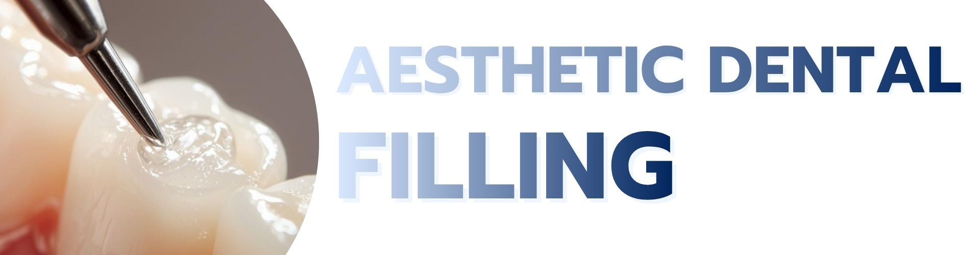 Aesthetic Dental Filling service