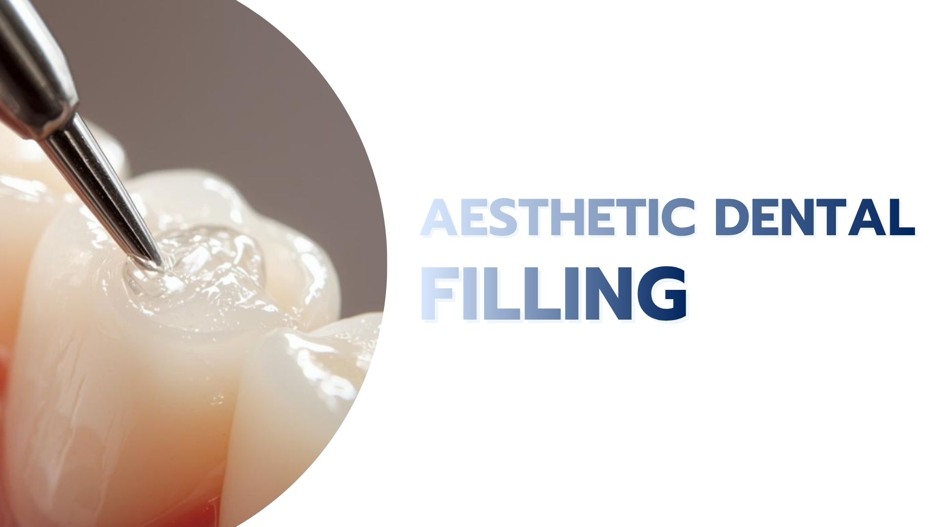 Aesthetic Dental Filling