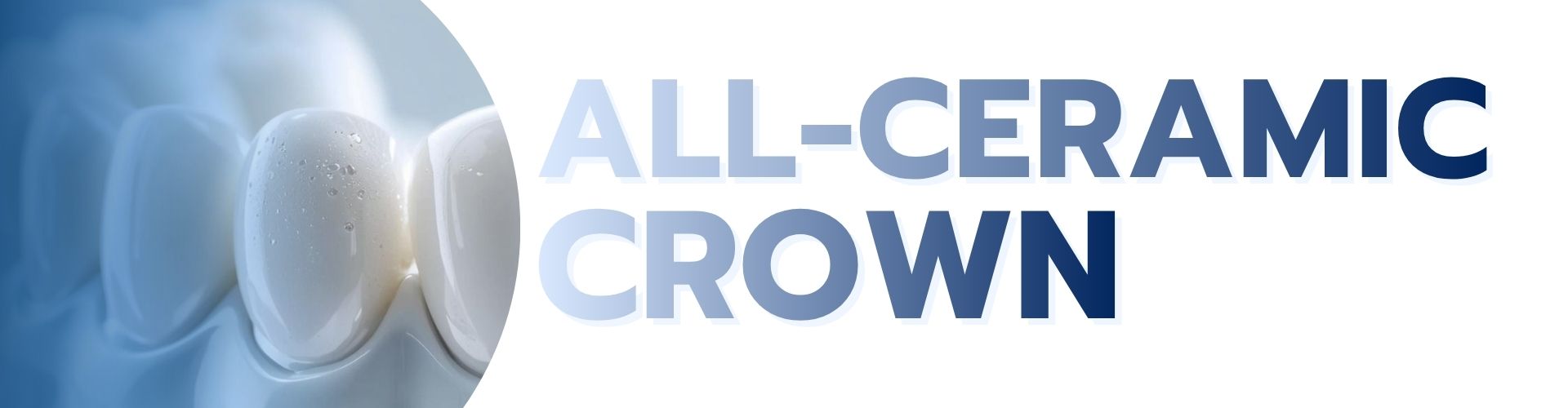 All-Ceramic Crown service