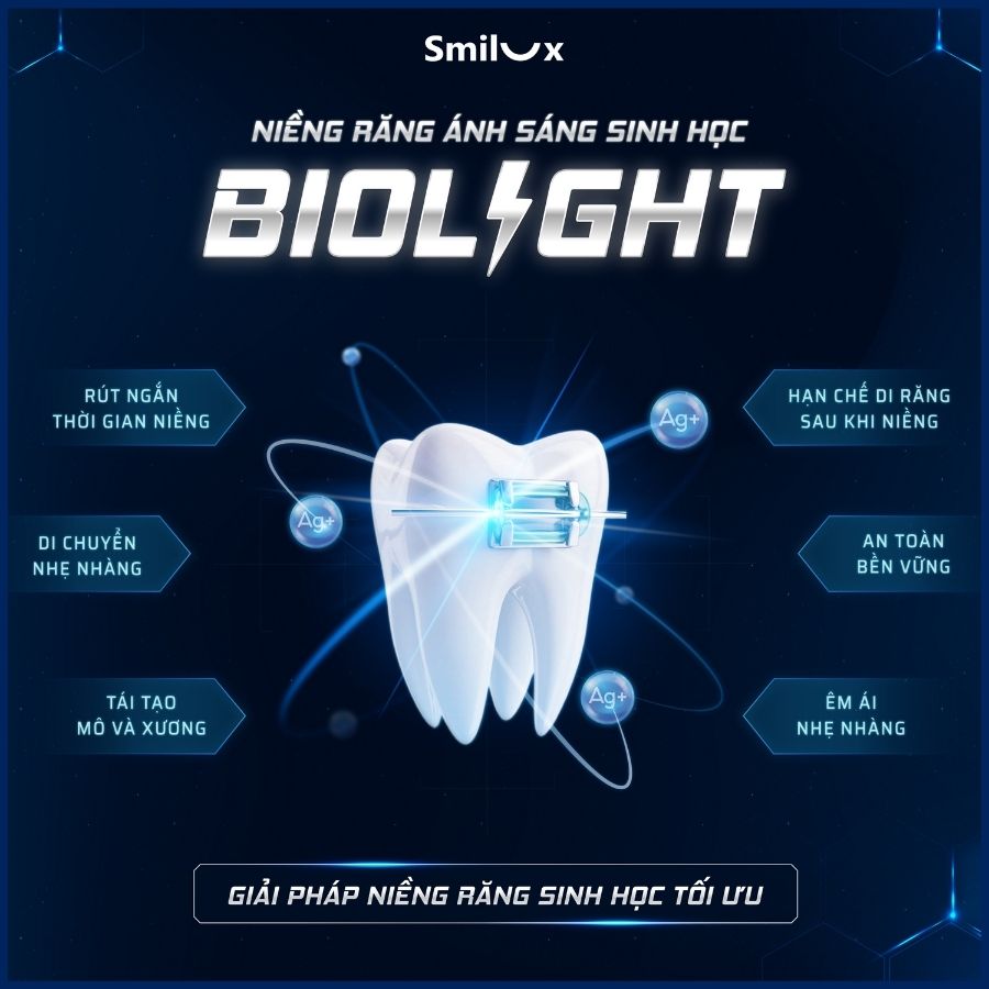 Banner 2 Biolight niềng răng
