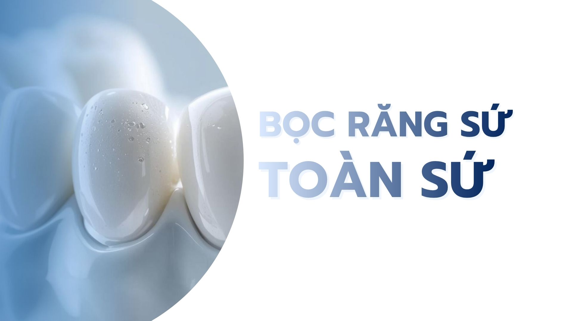 Bọc răng sứ toàn sứ