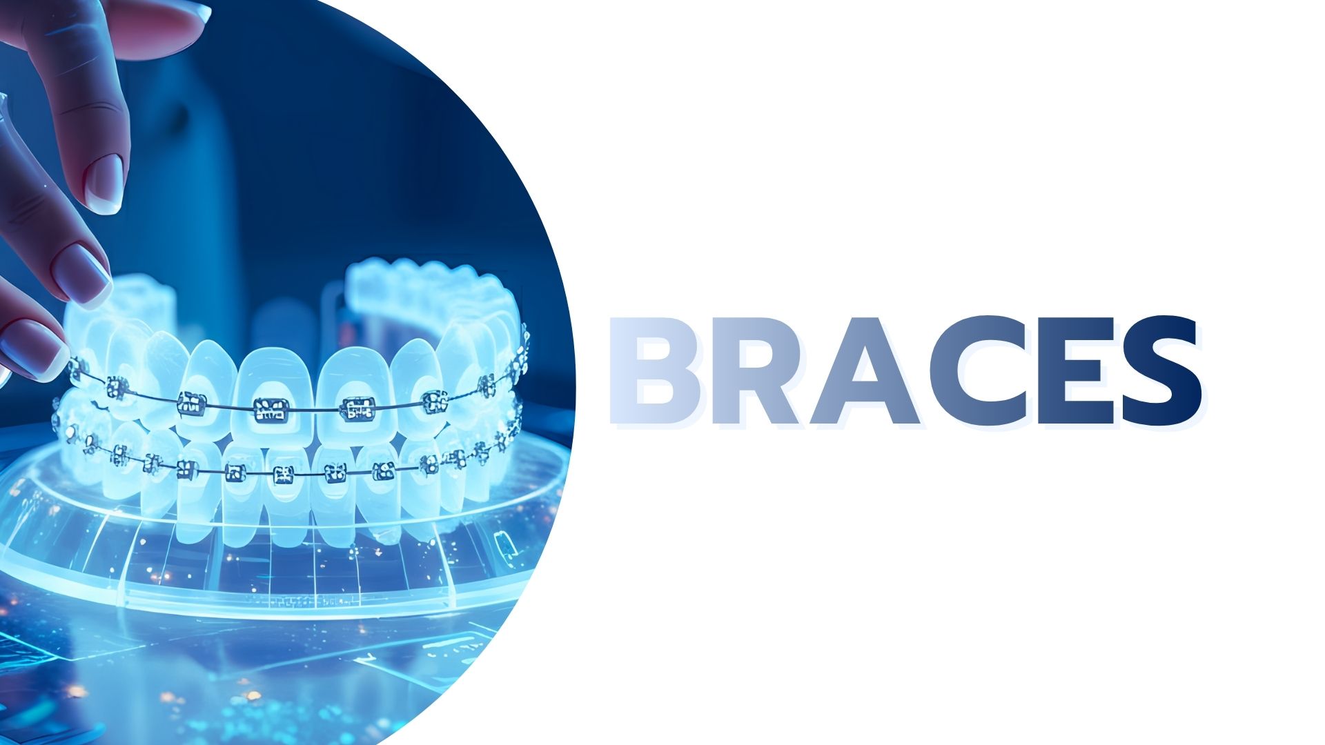 Braces 1