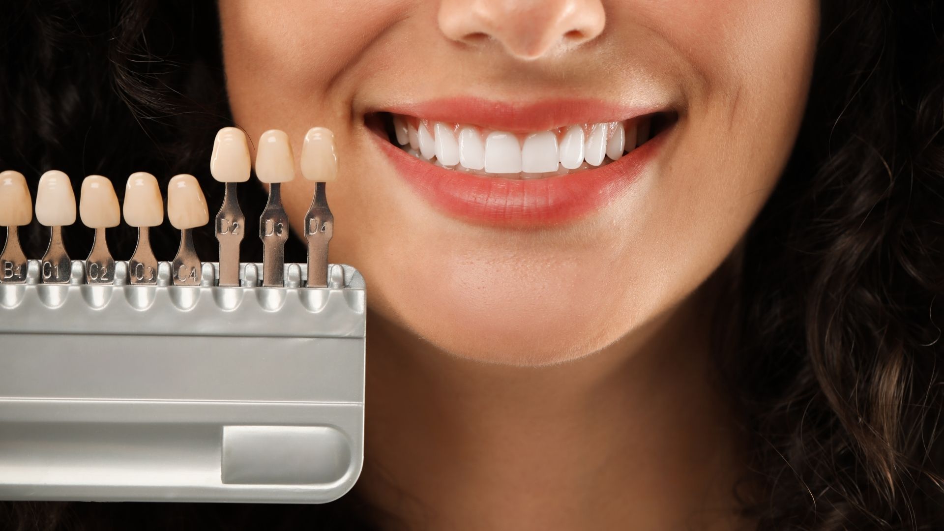 DÒNG SỨ VENEER LISI