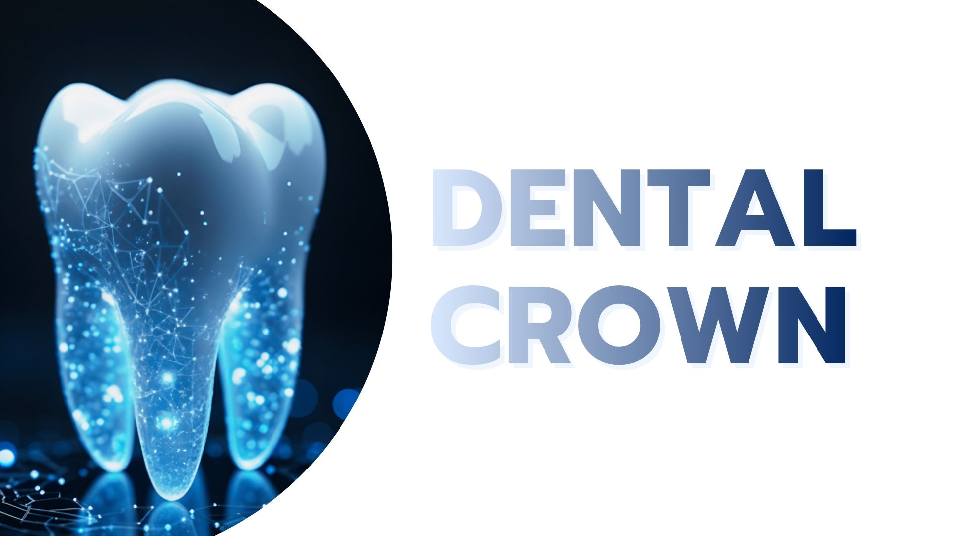 Dental Crown