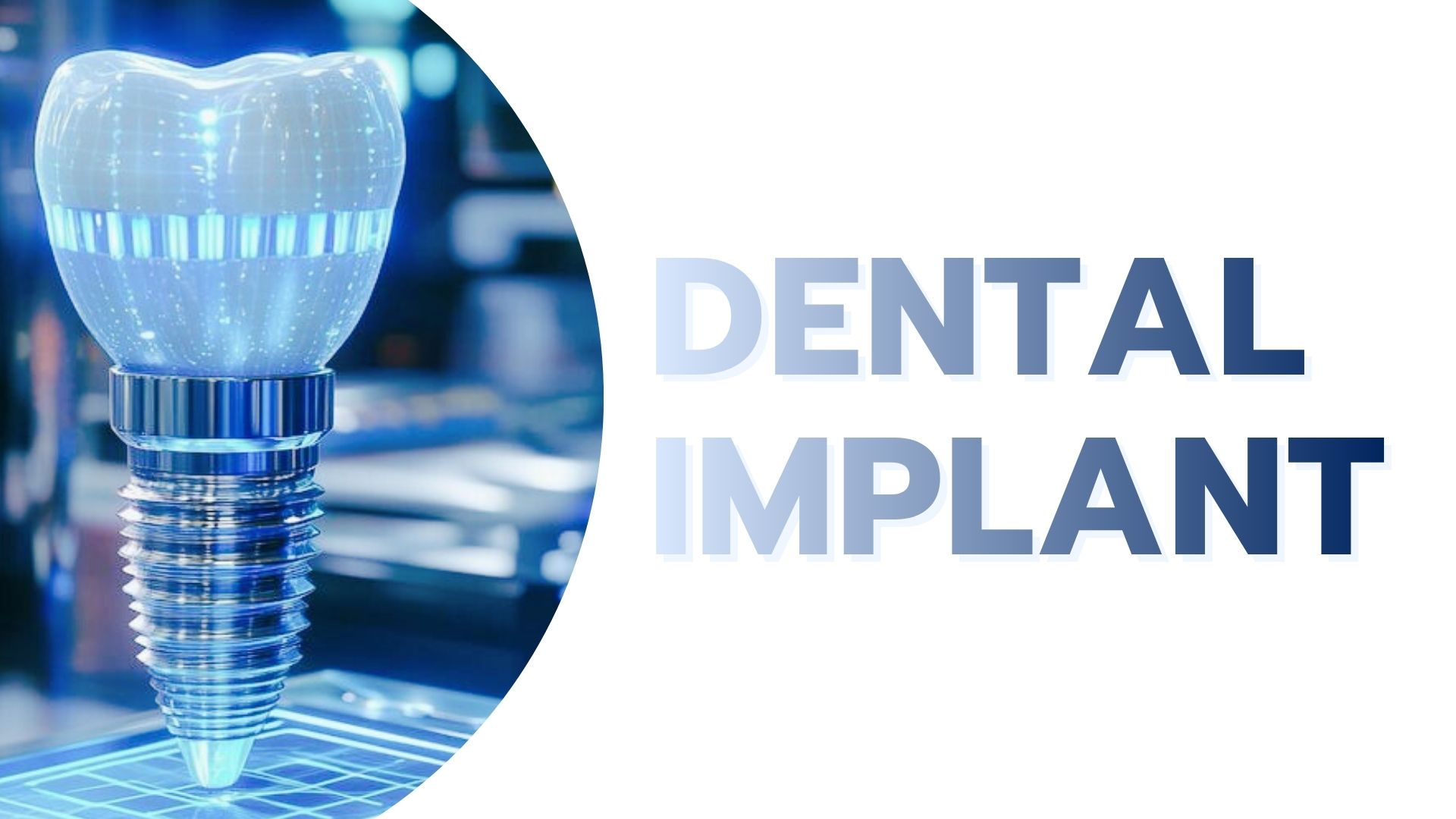 Dental implant 1