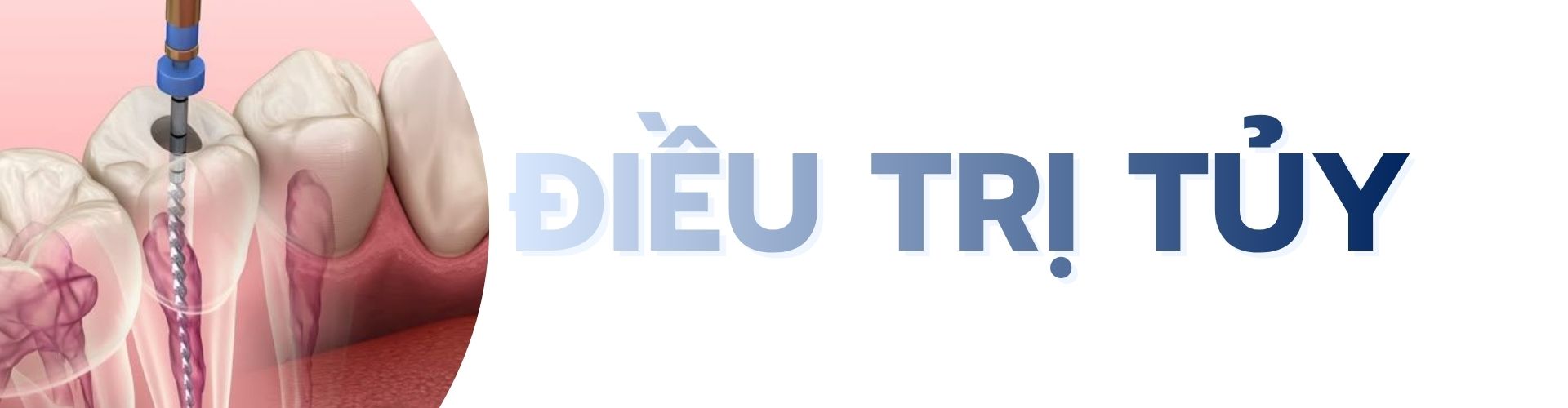 Điều trị tủy tại TPHCM quận phú nhuận