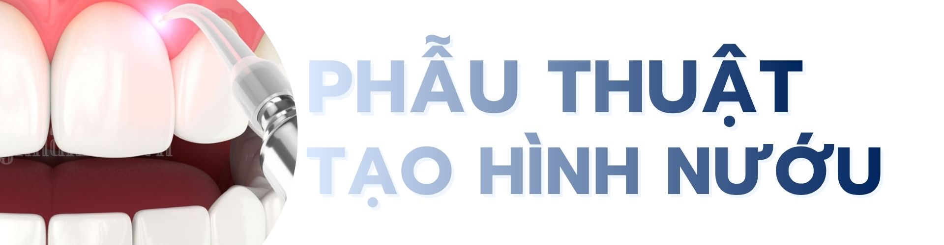 Phẫu thuật tạo hình nướu tại TPHCM quận phú nhuận