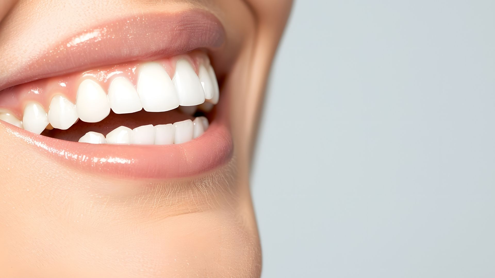 Răng sứ Diamond Esthetic Thụy Sỹ