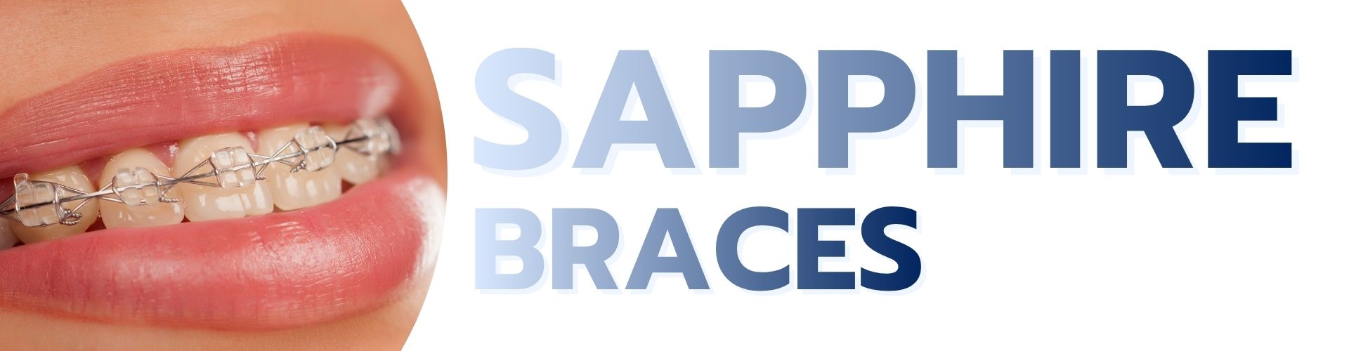 Sapphire Braces service