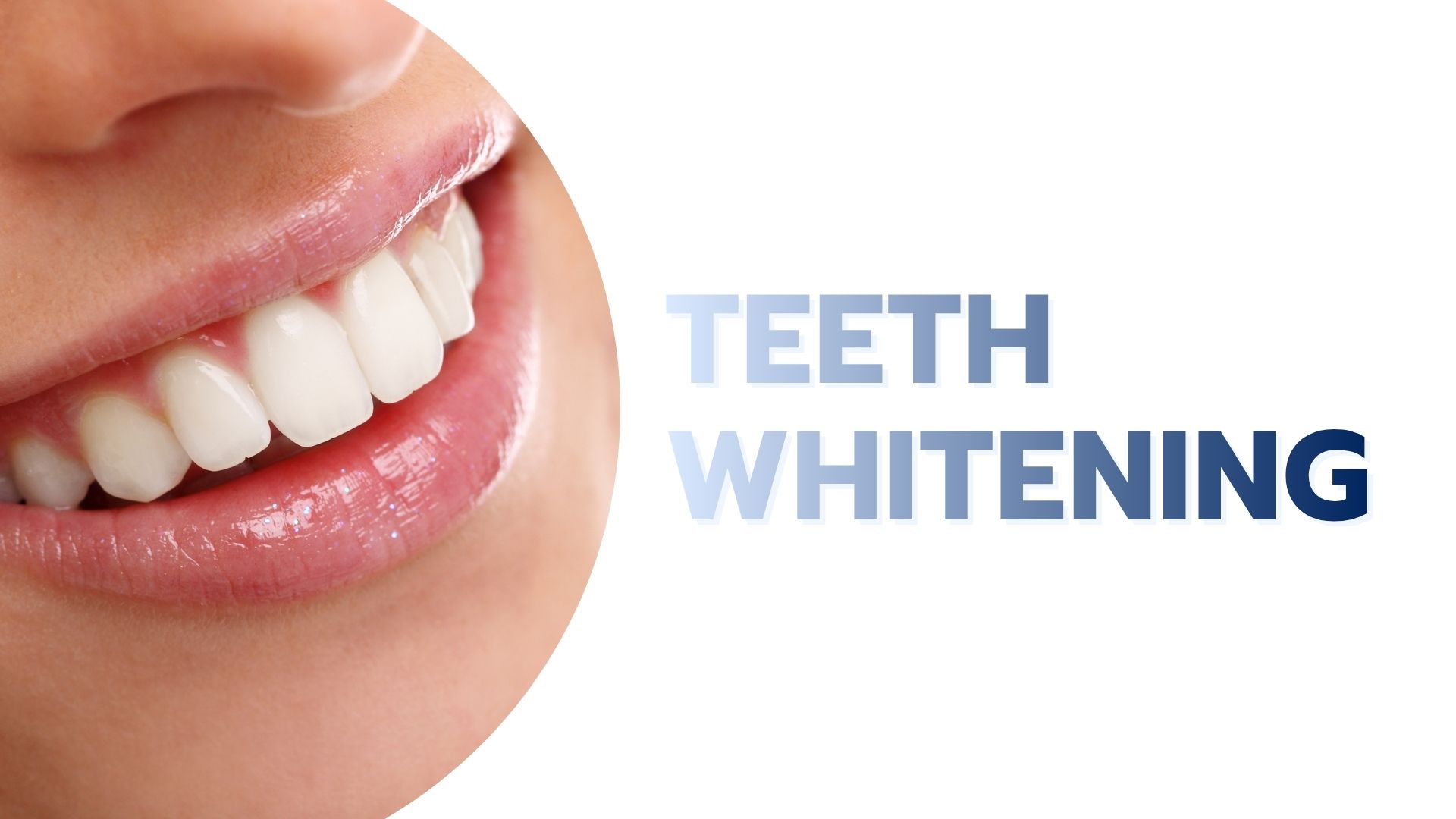 Teeth-Whitening.jpg