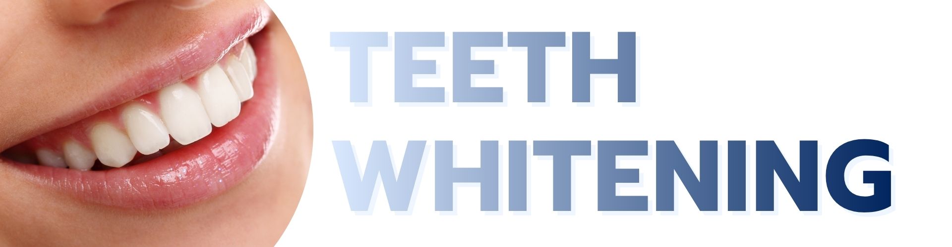 Teeth Whitening service