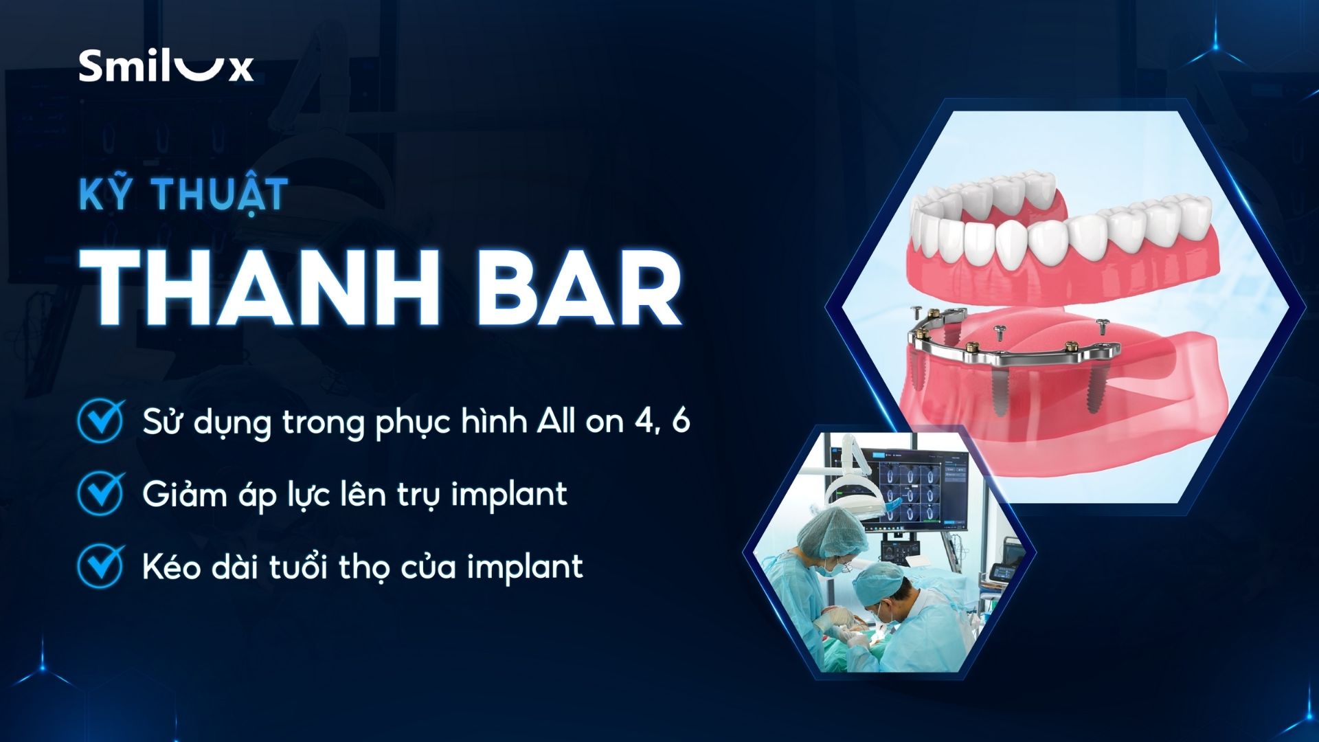 Thumb kỹ thuật thanh bar