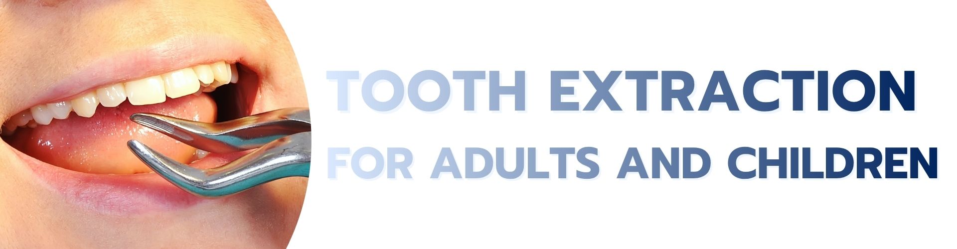 Tooth Extraction for Adults and Children service
