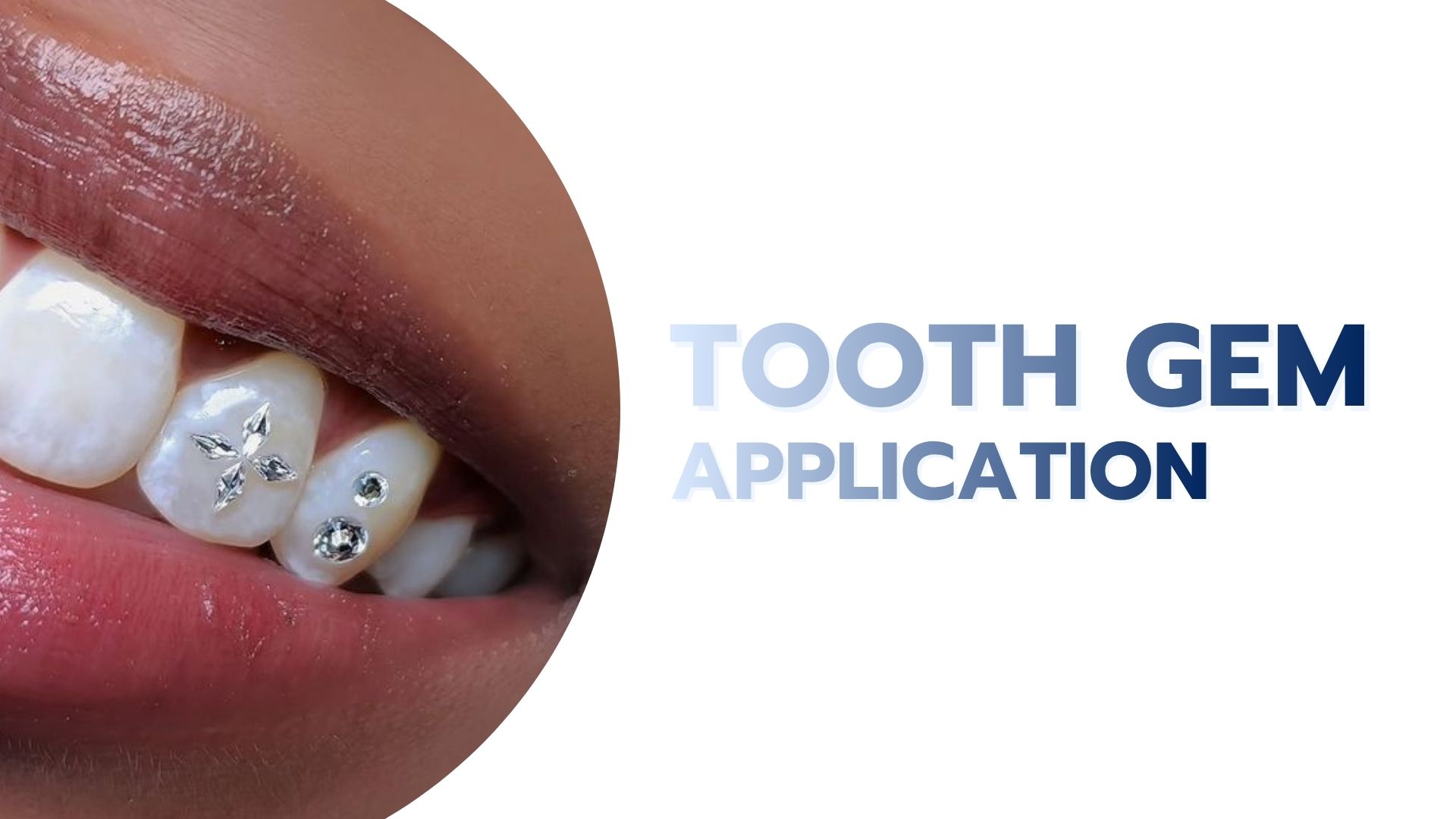 Tooth Gem Application
