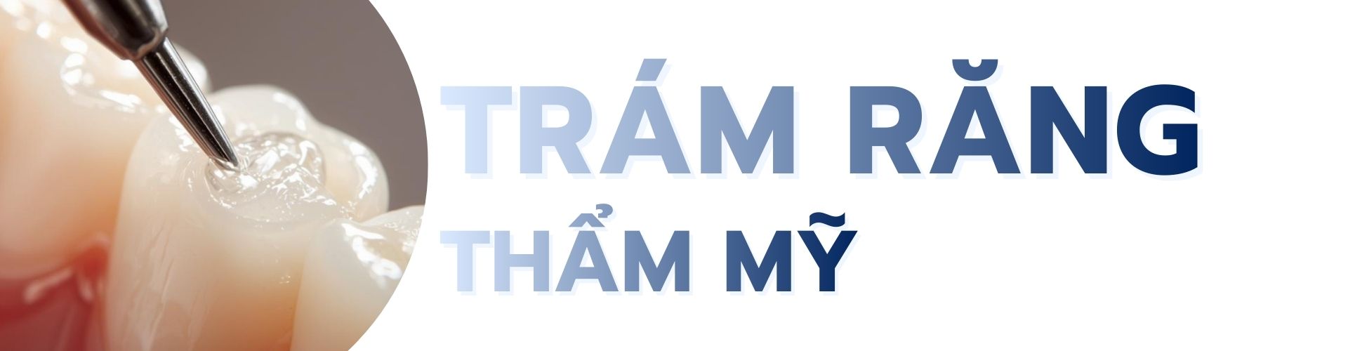 Trám răng thẩm mỹ tại TPHCM quận phú nhuận