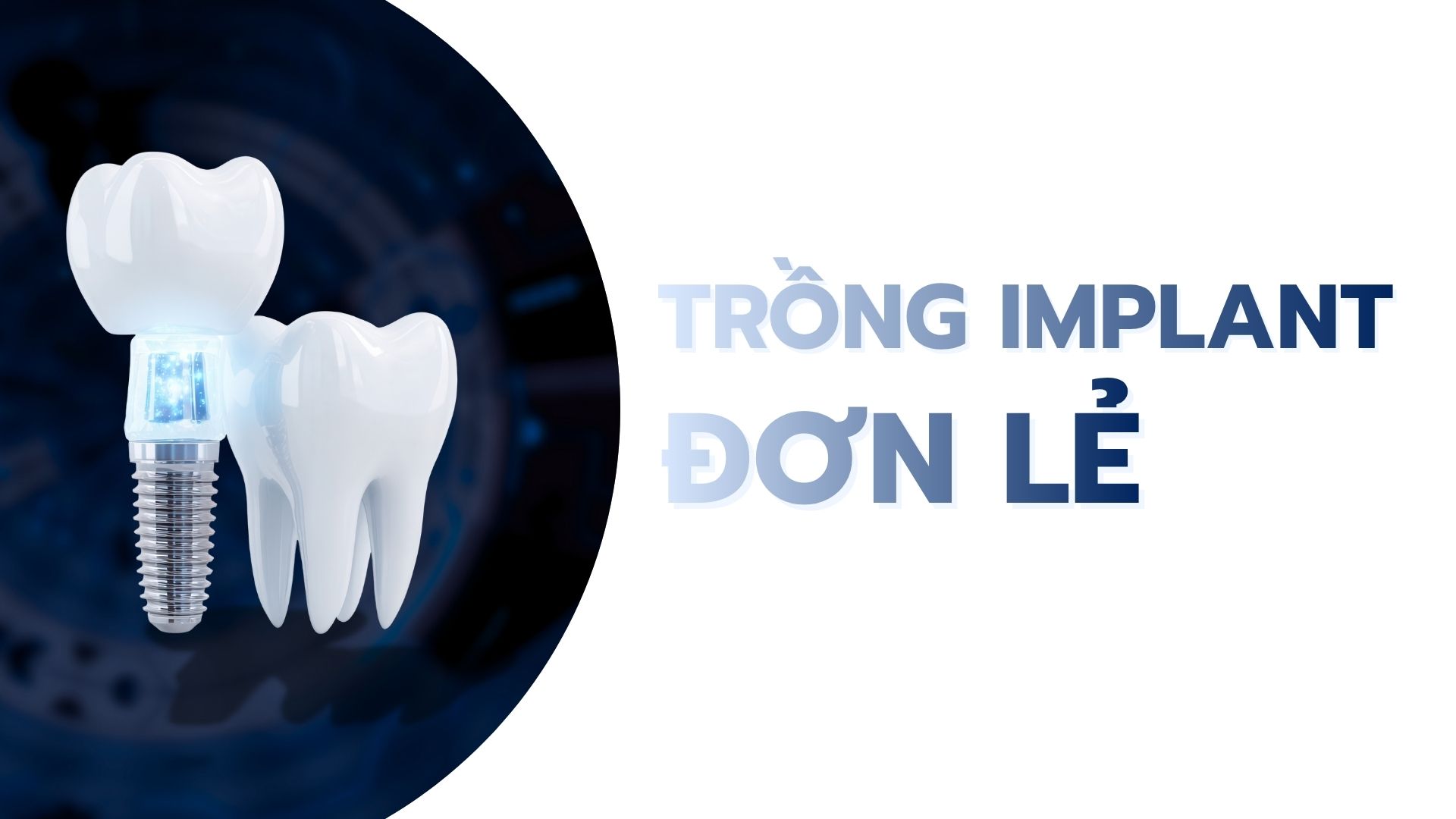 Trồng răng implant đơn lẻ