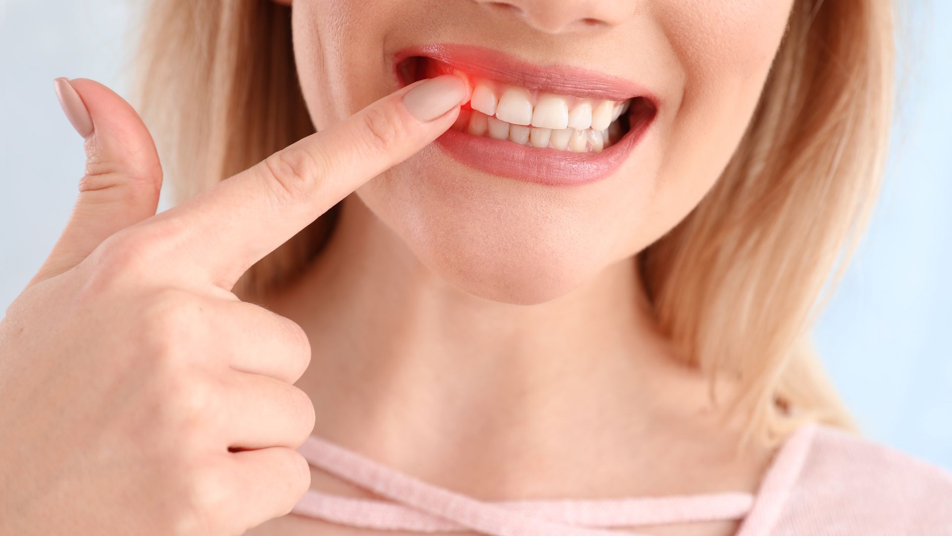 Trồng răng implant không rạch lợi, không đau, không viêm Dental implant without incision, no pain, no inflammation