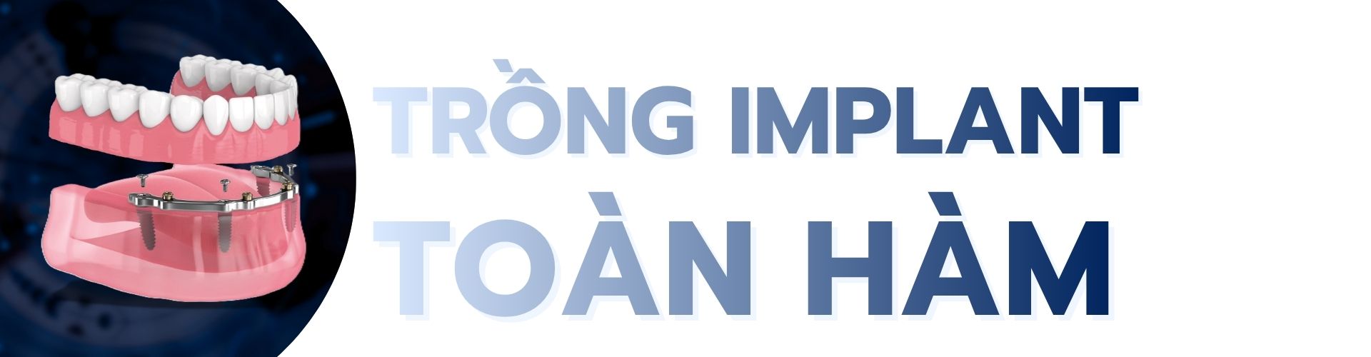 Trồng răng implant toàn hàm taij smilux có gì