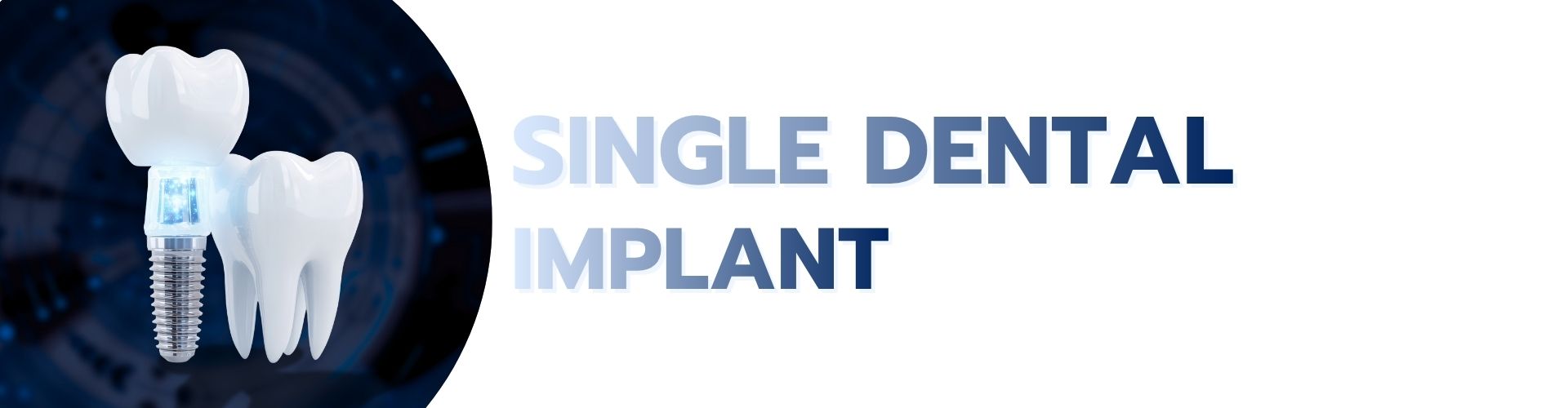 single dental implant SERVICES