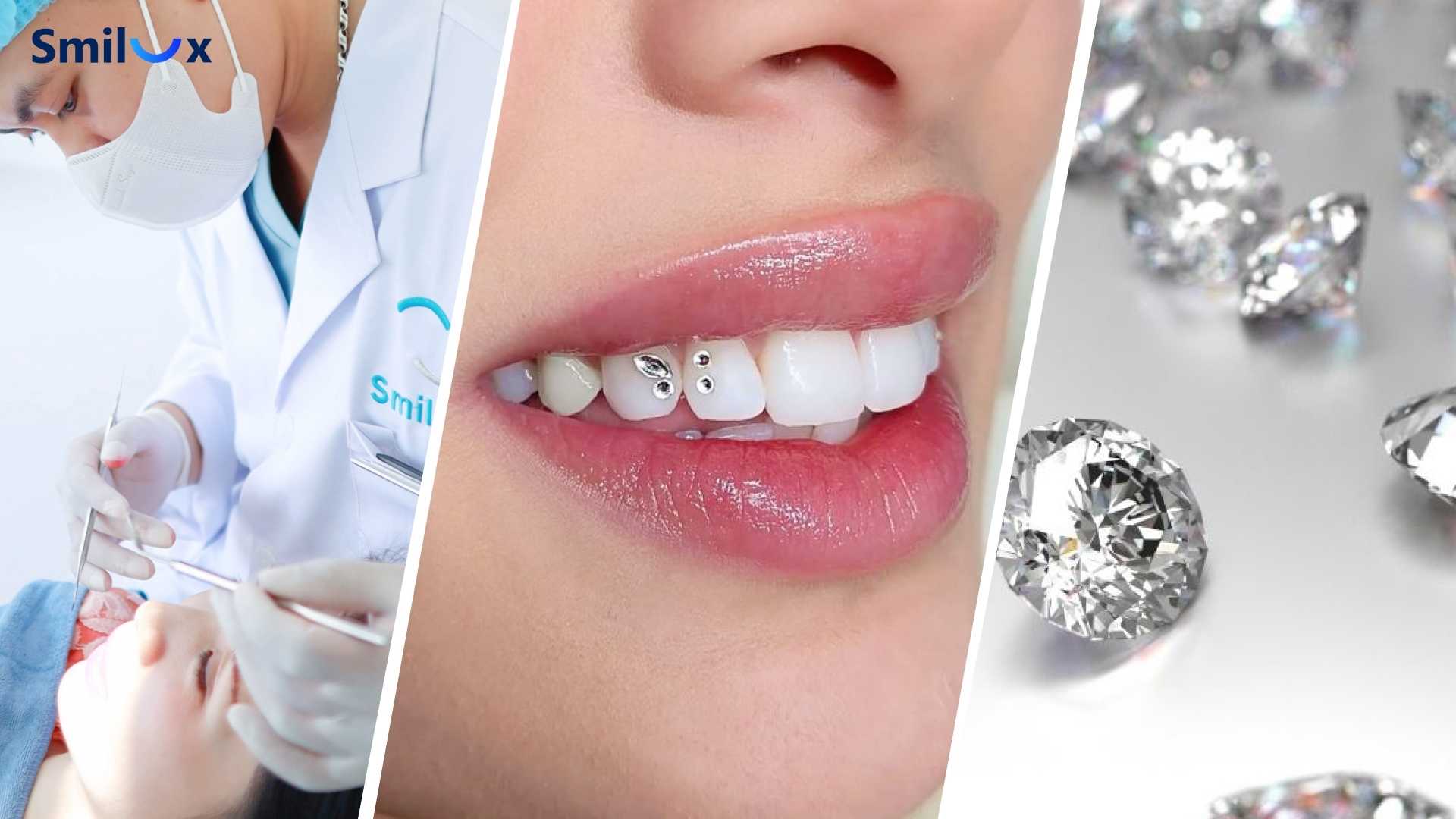 3 yếu tố lưu ý khi đính đá lên răng 3 things to keep in mind when attaching rhinestones to teeth
