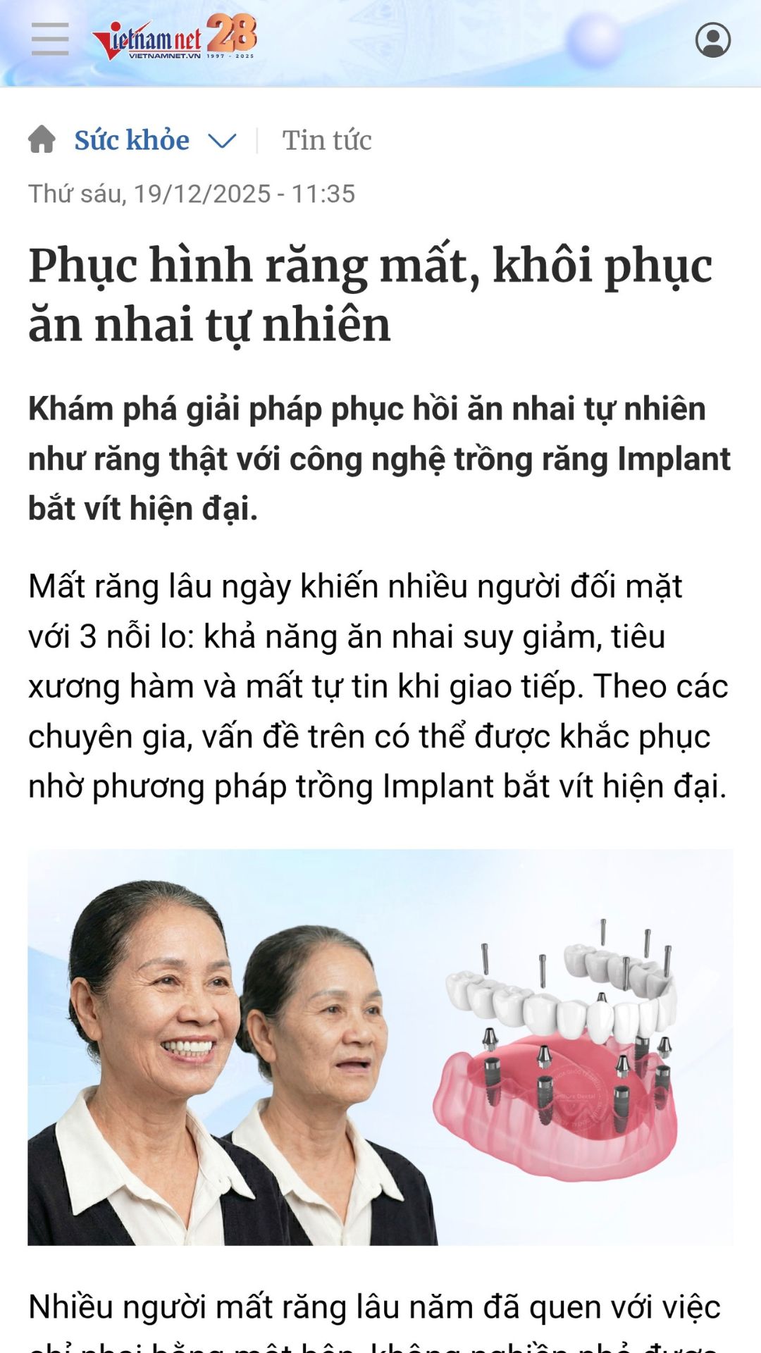 Bao vietnamnet noi gi ve
