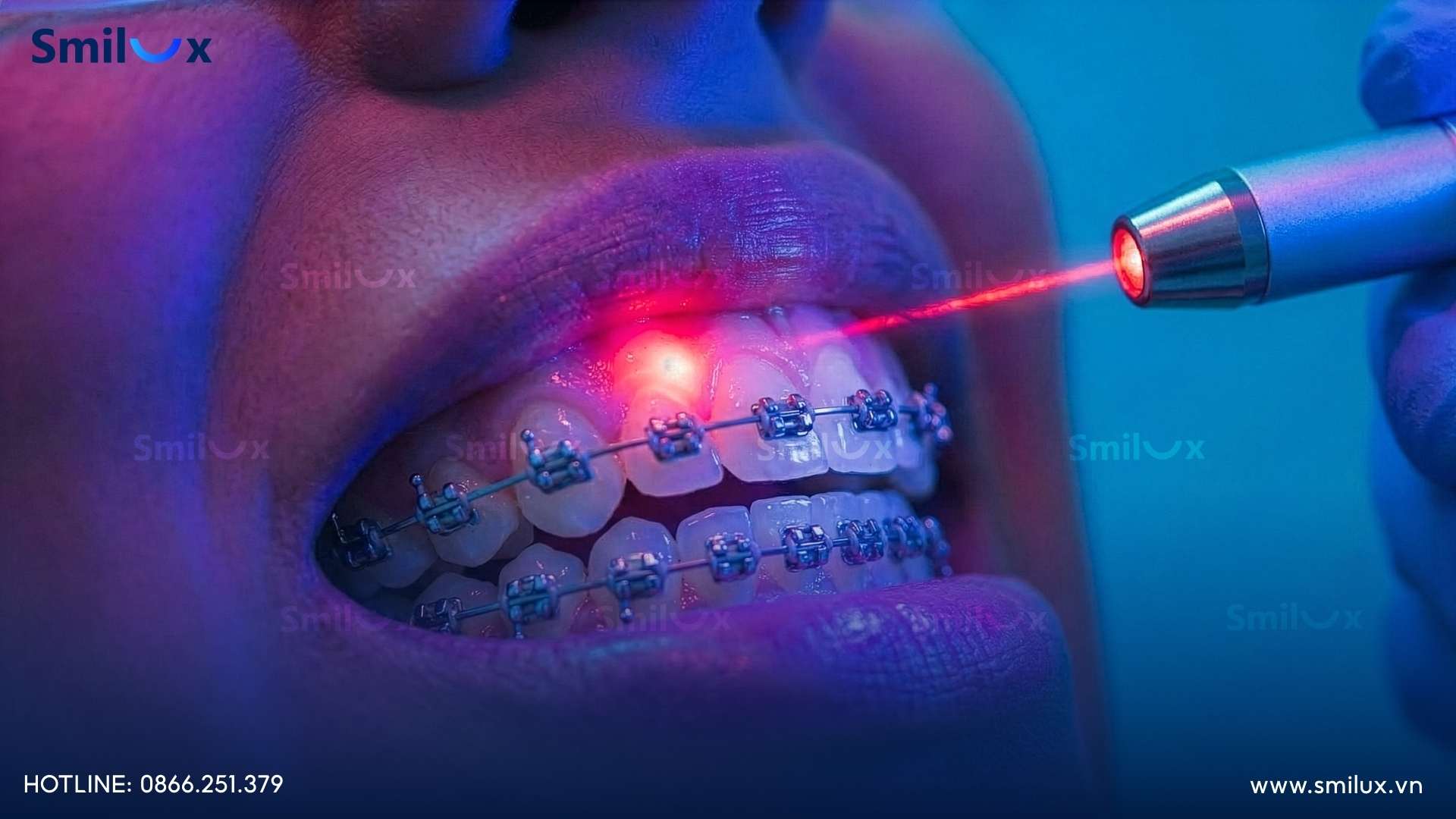 Cơ chế hoạt động của lực sinh học trong công nghệ BioLight The mechanism of action of bio-forces in BioLight technology