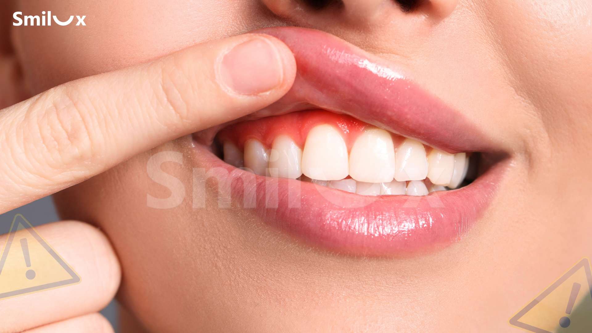 Những rủi ro khi làm tại địa chỉ không chuyên