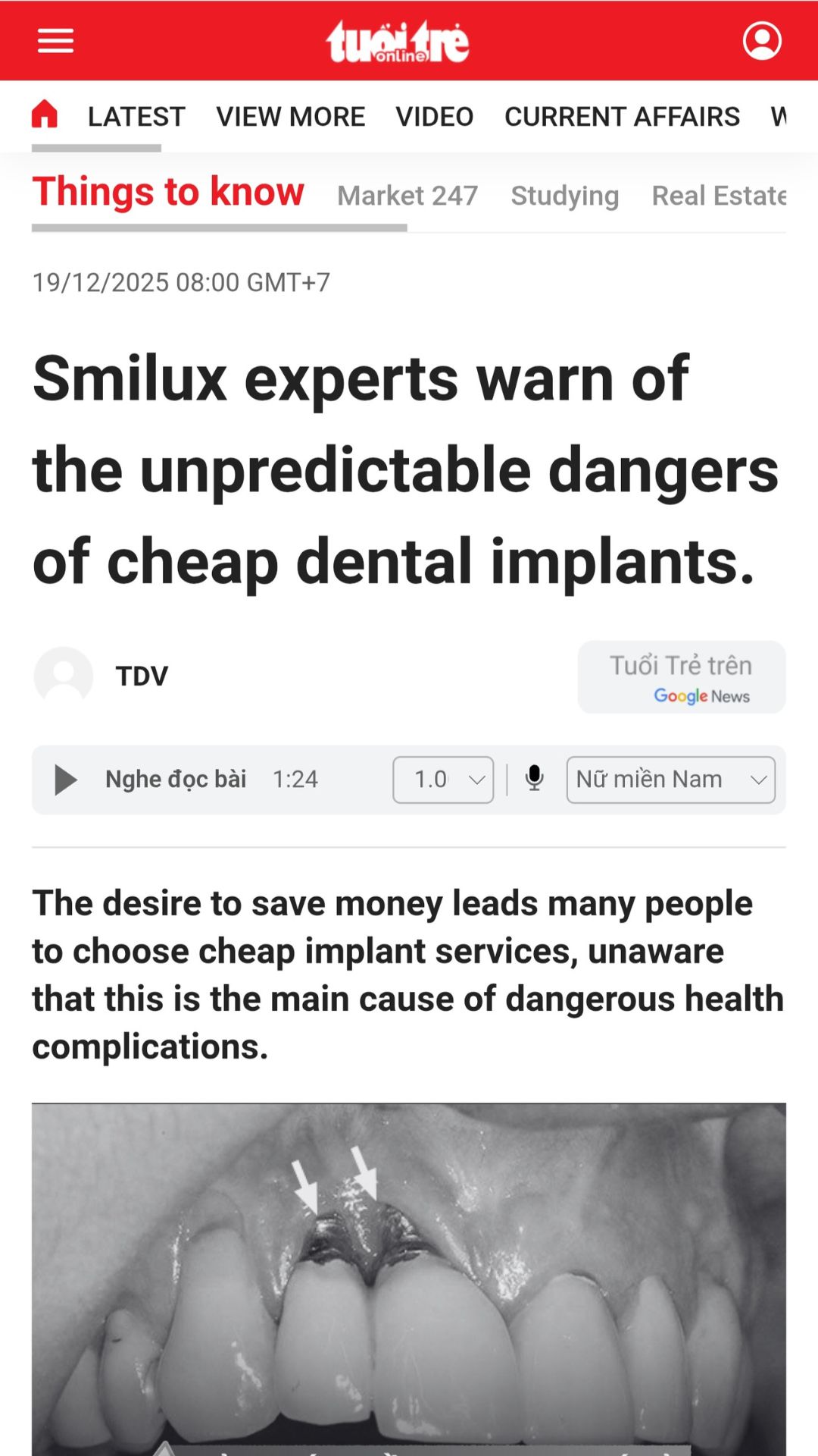 What did tuoitre newspaper say about Smilux dental
