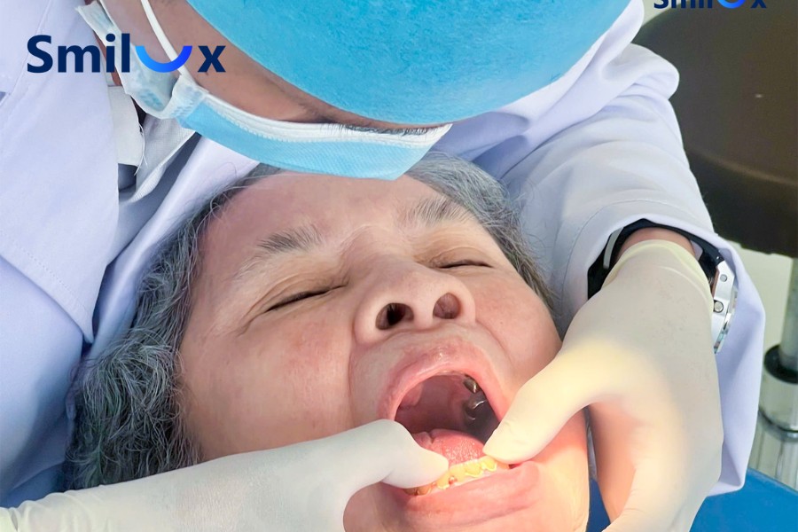 Các tiêu chí đánh giá nha khoa Implant tại TPHCM uy tín