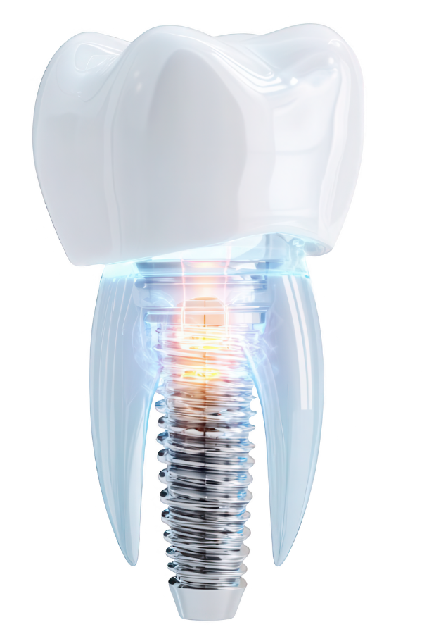 loi ich cua trong rang implant