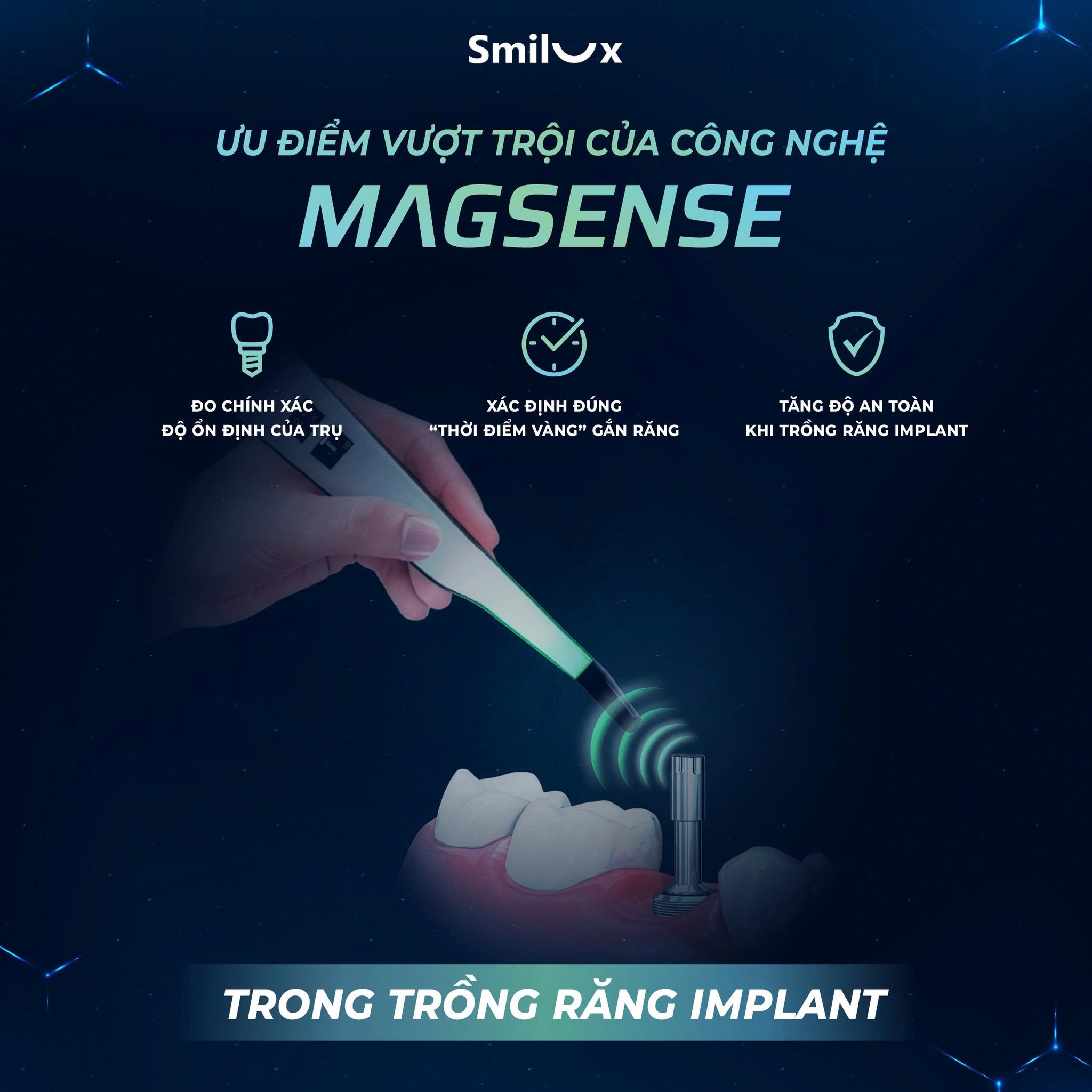 Ưu điểm vượt trội của công nghệ MAGSENSE
