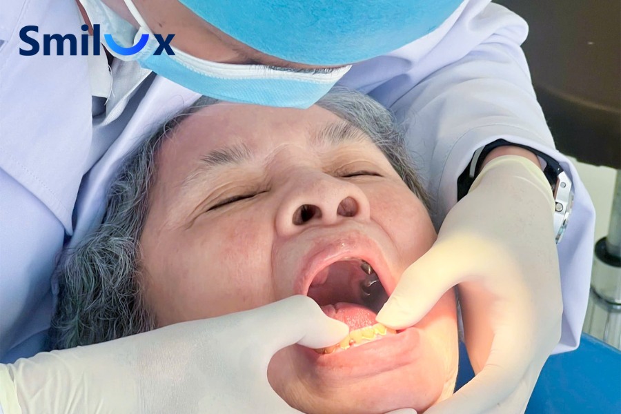 Bác sĩ theo dõi quá trình tích hợp xương