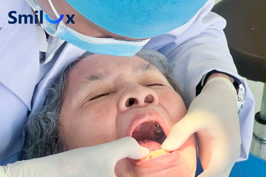 Tại sao nên chọn trồng răng Implant tại Smilux Dental?