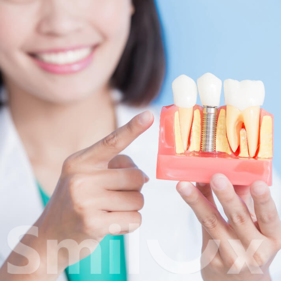 Trồng răng Implant có bị hôi miệng không? Nguyên nhân và cách hạn chế