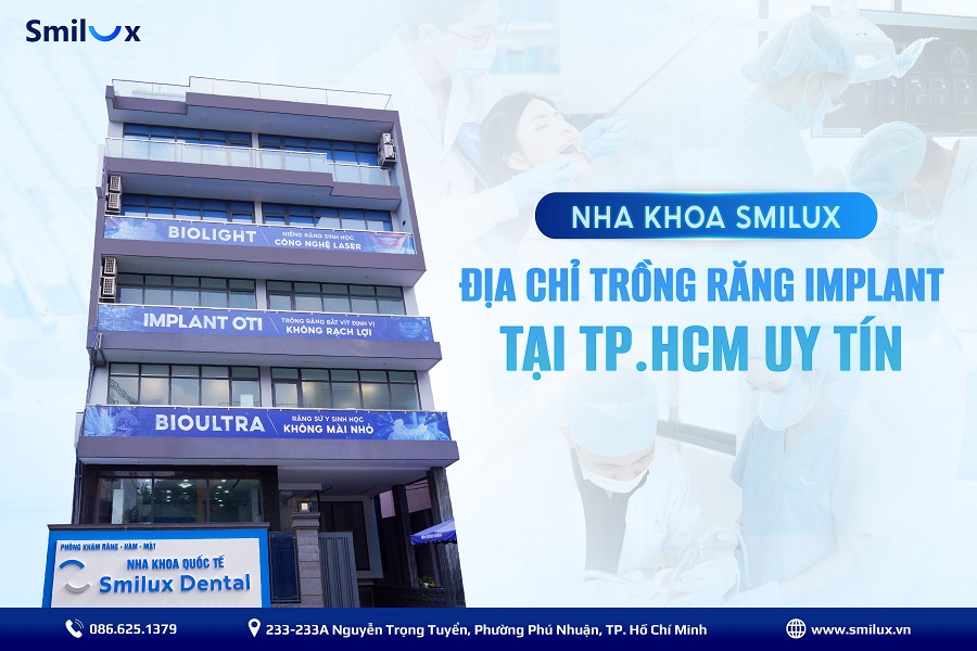 Nha khoa trồng răng Implant tại TPHCM uy tín - Bác sĩ giỏi
