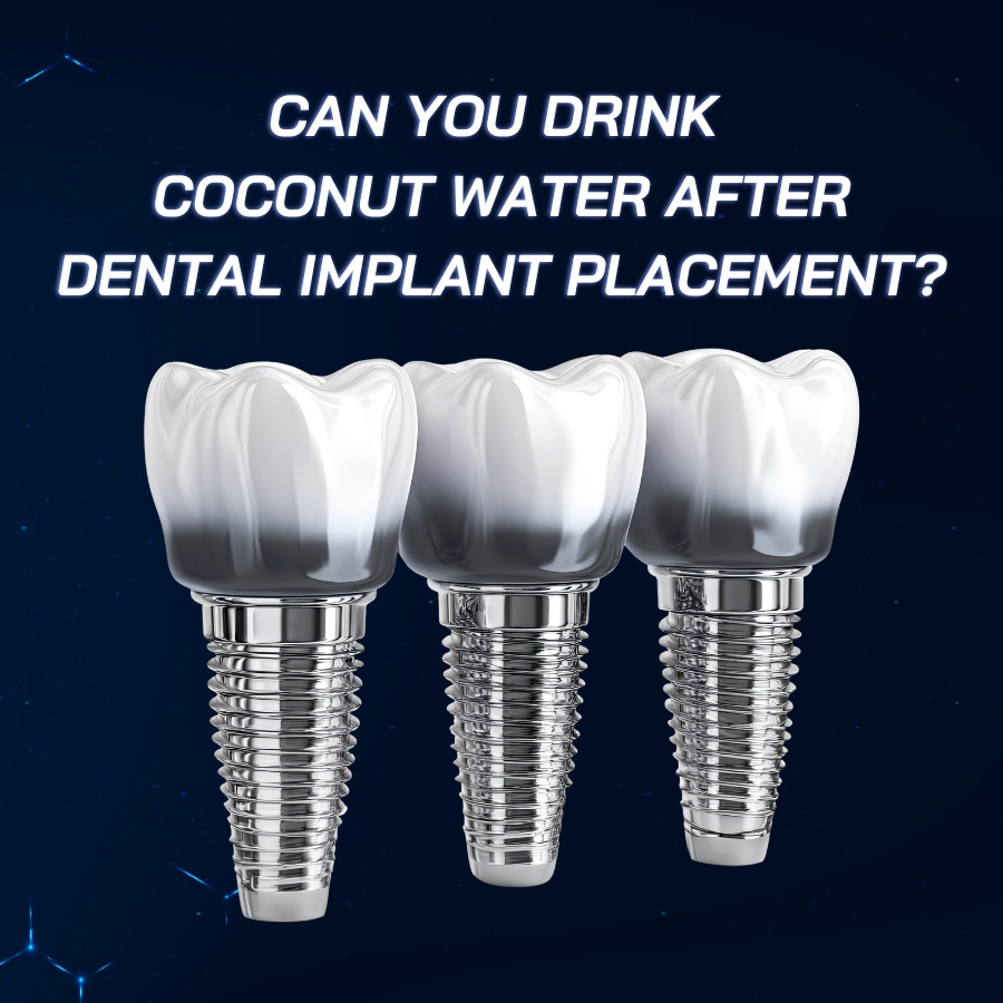 Can you drink coconut water after dental implant placement smilux dental
