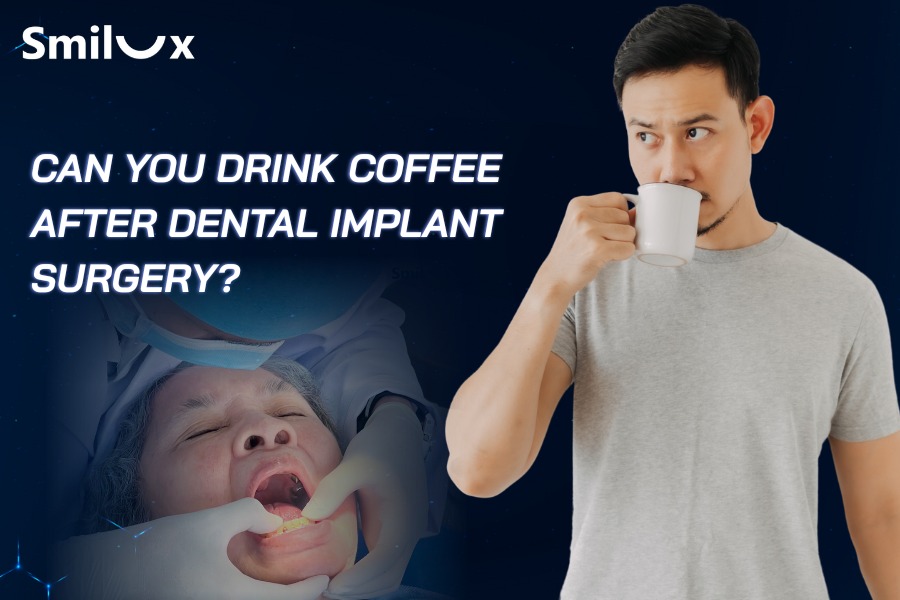 Can You Drink Coffee After Dental Implant Surgery? Can You Drink Coffee After Dental Implant Surgery?