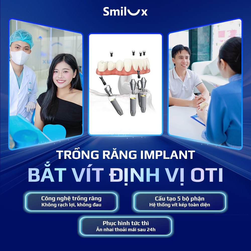 Công nghệ trồng răng OTI thế hệ mới tại Smilux giúp đẩy nhanh quá trình hồi phục Công nghệ trồng răng OTI thế hệ mới tại Smilux giúp đẩy nhanh quá trình hồi phục