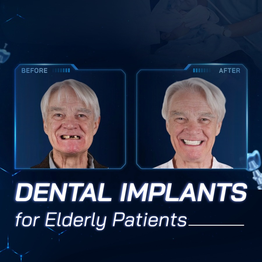 dental implants for elderly patients
