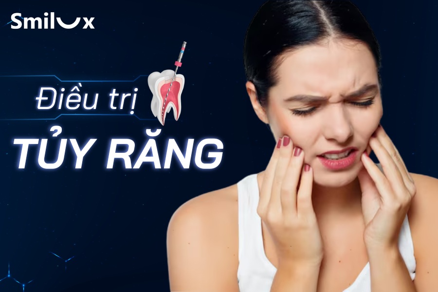 Điều trị tủy răng là như thế nào? Chữa tủy tốn bao nhiêu tiền? Điều trị tủy răng là như thế nào? Chữa tủy tốn bao nhiêu tiền?