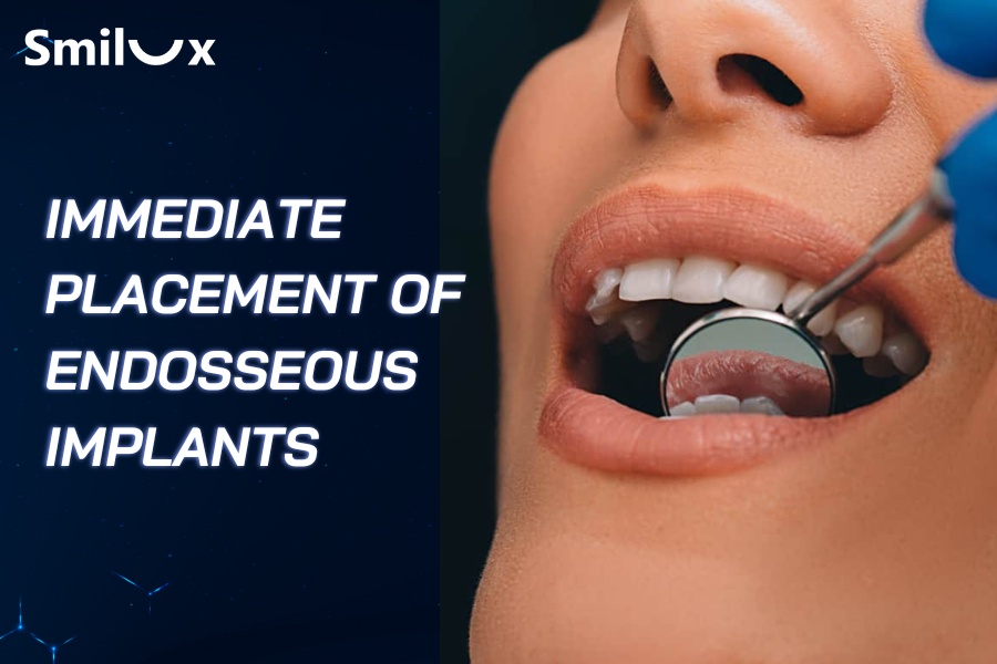 What Is Immediate Placement of Endosseous Implants? When Is It Indicated? What Is Immediate Placement of Endosseous Implants? When Is It Indicated?