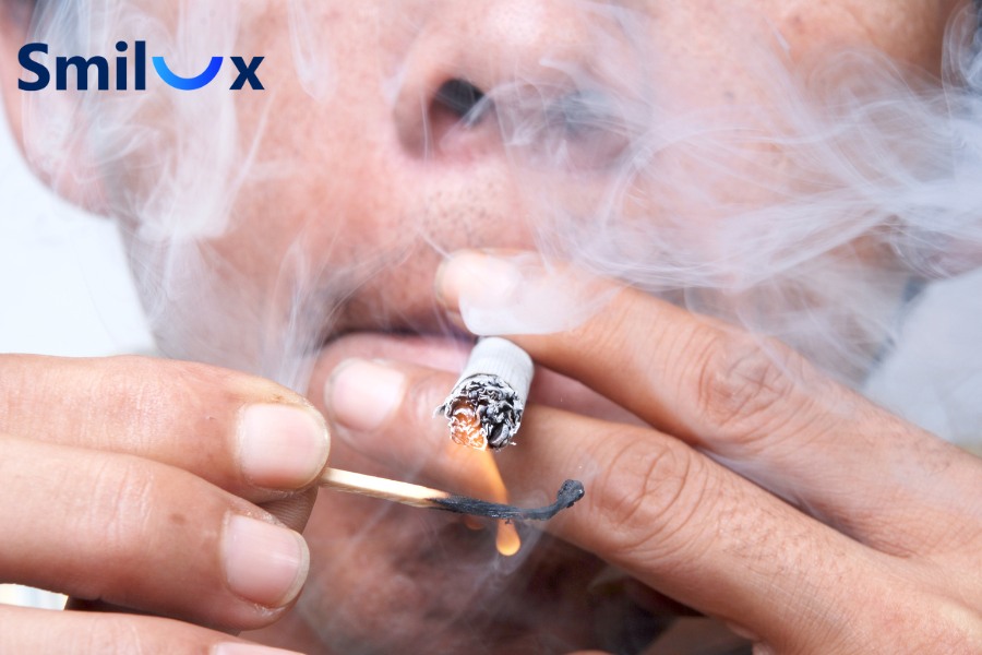 Không hút thuốc trước và sau khi cấy Implant tức thì Không hút thuốc trước và sau khi cấy Implant tức thì