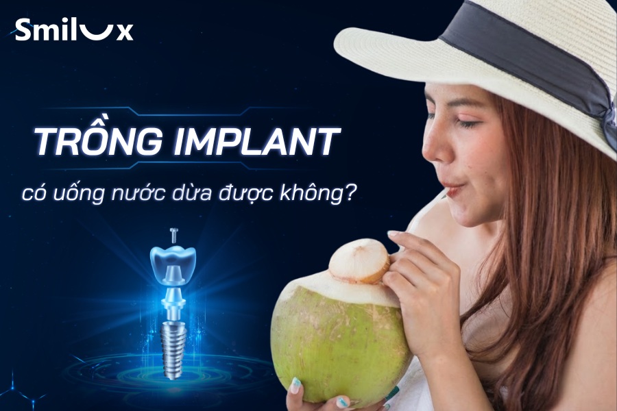 Trồng Implant uống nước dừa được không? Smilux giải đáp Trồng Implant uống nước dừa được không? Smilux giải đáp