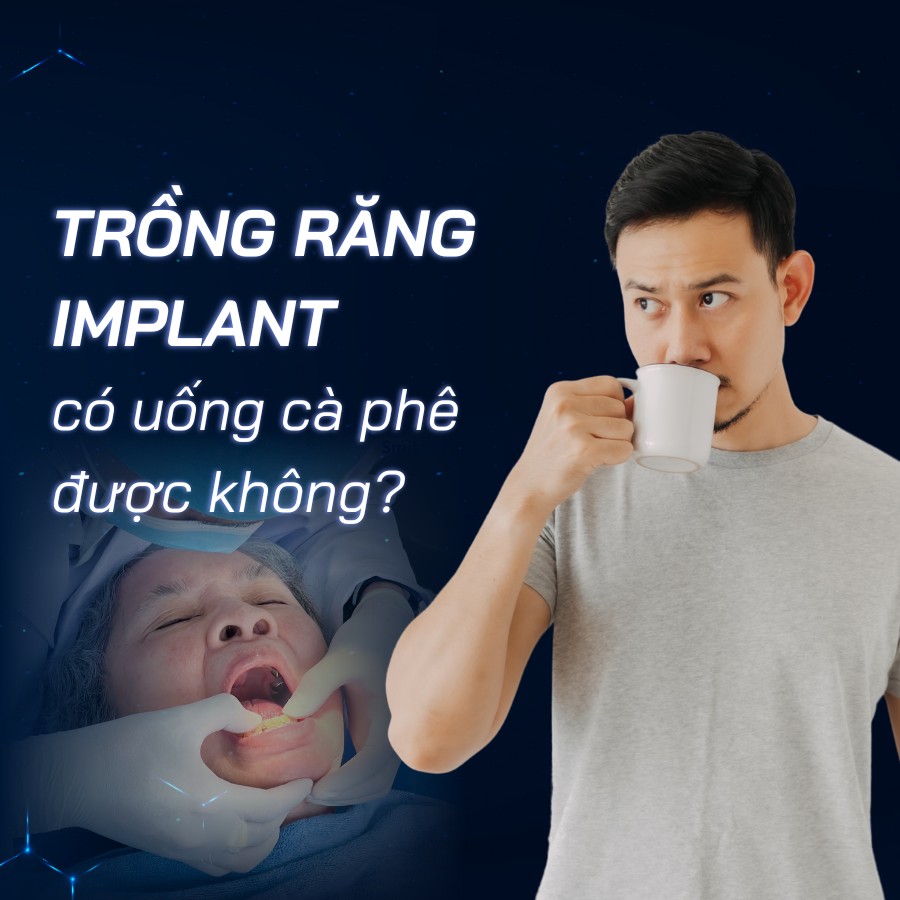 trồng răng implant có uống cà phê được không smilux dental