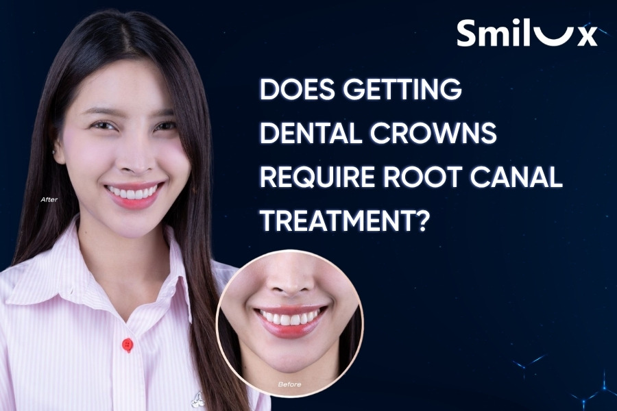 Does getting dental crowns require root canal treatment? Does getting dental crowns require root canal treatment?