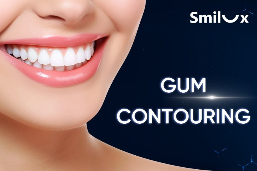 Gum Contouring: Benefits, Procedure, and Cost Gum Contouring: Benefits, Procedure, and Cost