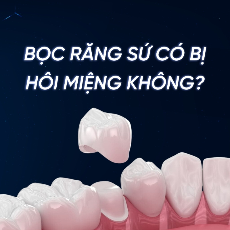 Bọc răng sứ có bị hôi miệng không? Cách trị hôi miệng khi bọc răng