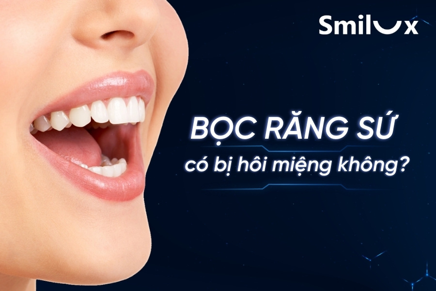 Bọc răng sứ có bị hôi miệng không? Cách trị hôi miệng khi bọc răng Bọc răng sứ có bị hôi miệng không? Cách trị hôi miệng khi bọc răng
