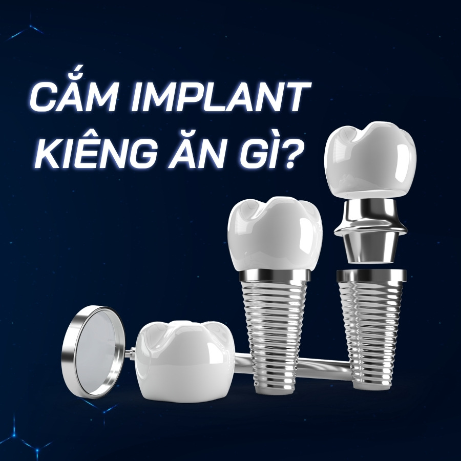 cắm implant kiêng ăn gì smilux