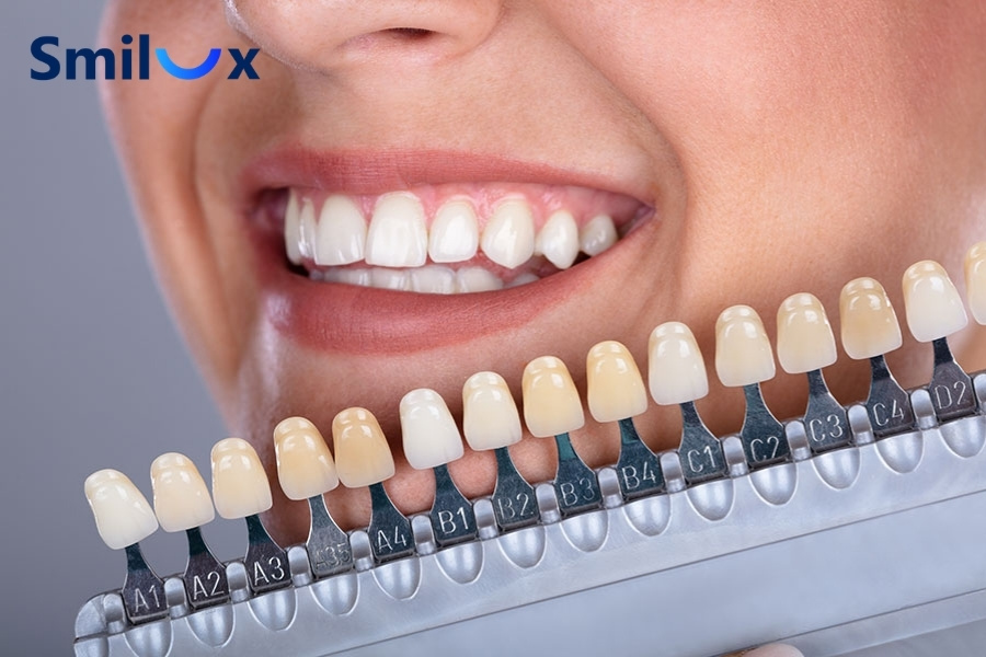 Nếu răng bạn bị ố vàng do ăn uống (cà phê, trà), hút thuốc hoặc xỉn màu theo thời gian thì tẩy trắng là giải pháp lý tưởng Nếu răng bạn bị ố vàng do ăn uống (cà phê, trà), hút thuốc hoặc xỉn màu theo thời gian thì tẩy trắng là giải pháp lý tưởng